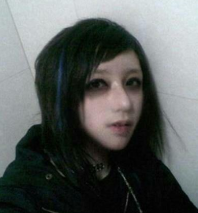 ‘太阳集团tyc’整形失败修复公益援助平台 让求美者得到专业的医疗救助(图2) 太阳成集团tyc